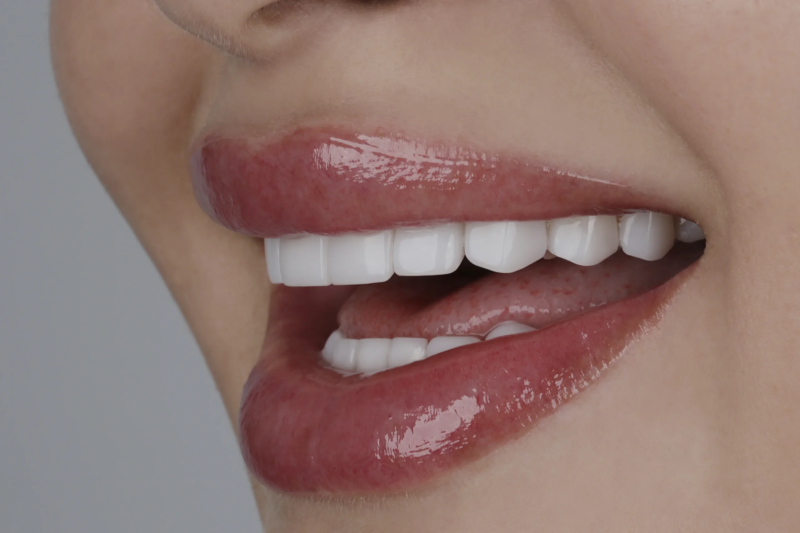 Qué es el diseño de sonrisa - Dental & Design Group