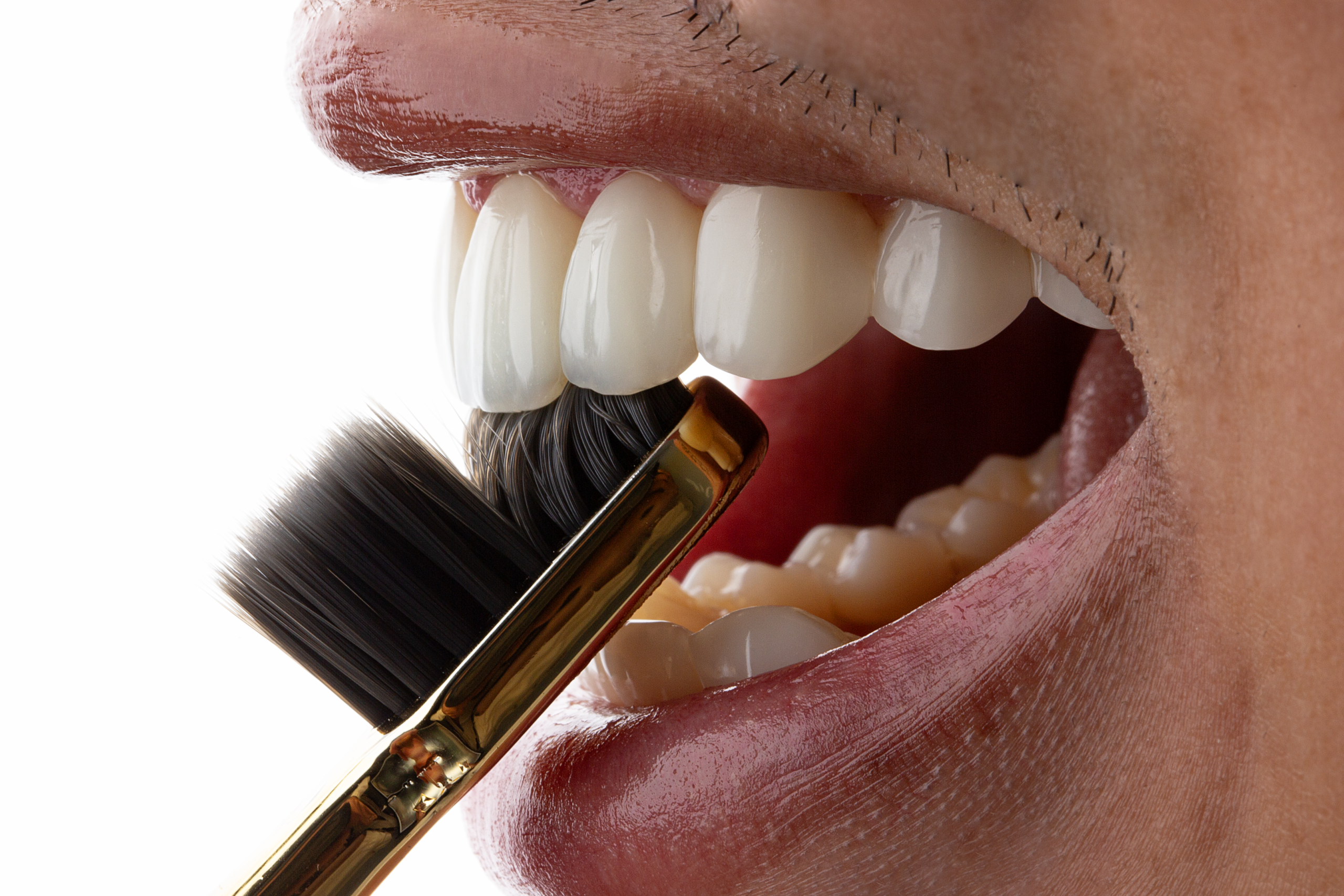 foto lateral de carillas de composite estratificadas en boca con cepillo dental.