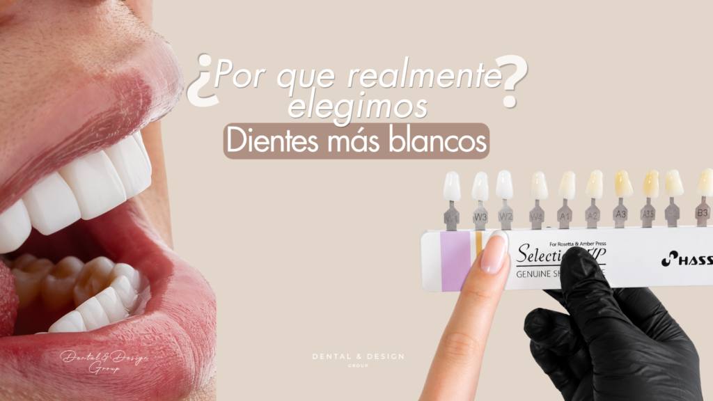 Guía de tonos de blanco para carillas dentales - selección de color natural
