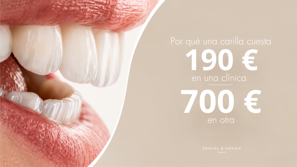 Precio de las carillas dentales en España: comparativa de 190 € frente a 700 € por carilla